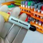 Sermorelin as an Alternative to Growth Hormone Replacement Therapy